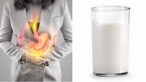 El reflujo gastroesofágico se caracteriza por una sensación de ardor o quemazón. Foto: Getty Images. Montaje SEMANA.