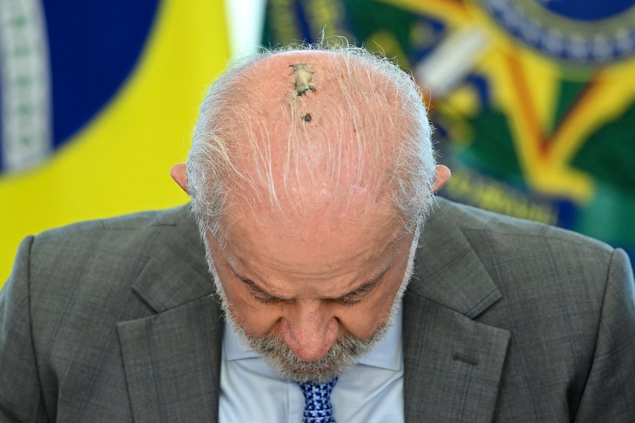 Luiz Inacio Lula da Silva