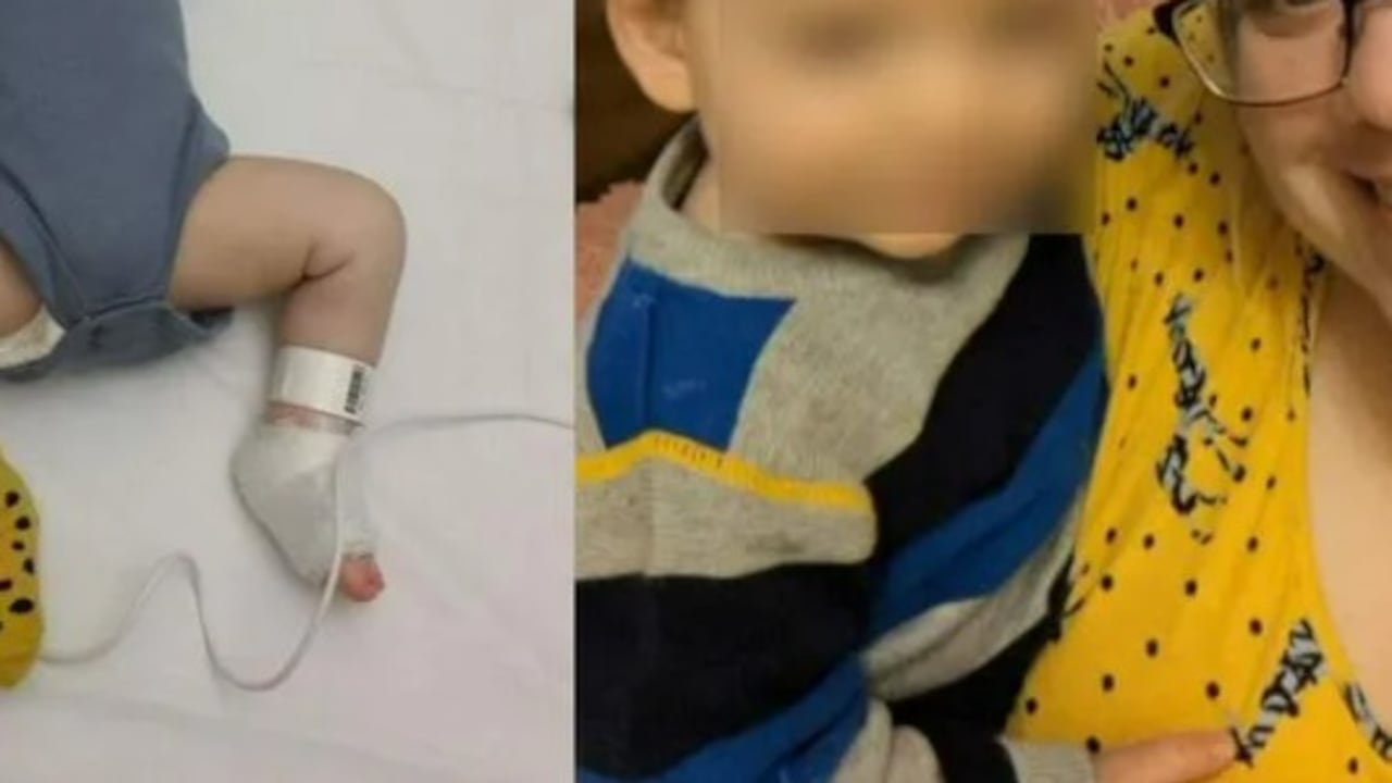 Gracias a la rápida detección de su madre, el menor pudo recibir tratamiento.