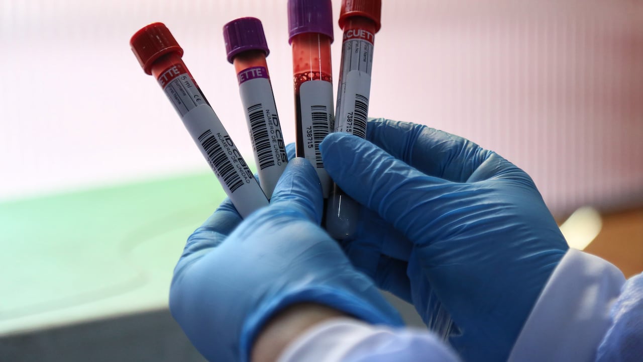 Sangre, hemofilia, salud, enfermedad