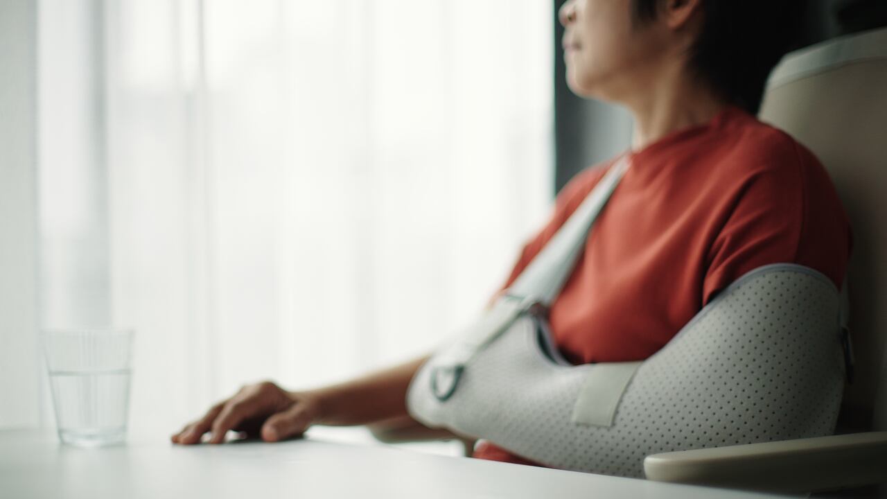 ¿Qué significa soñar con la fractura de un hueso?