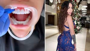 La empresaria e influencer incrustó 80 diamantes en sus dientes.