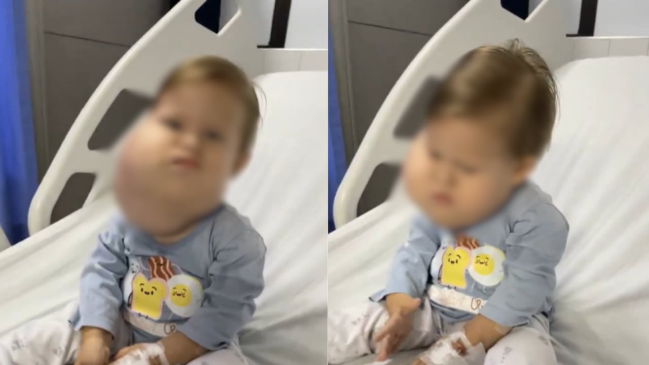 El niño cucuteño había sido trasladado a Floridablanca, Santander, para ser atendido.