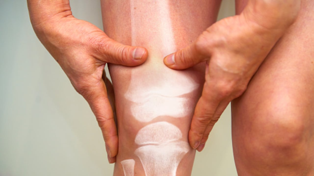 Enfermedades degenerativas de los huesos y las articulaciones | Dr Miguel Gonzalez