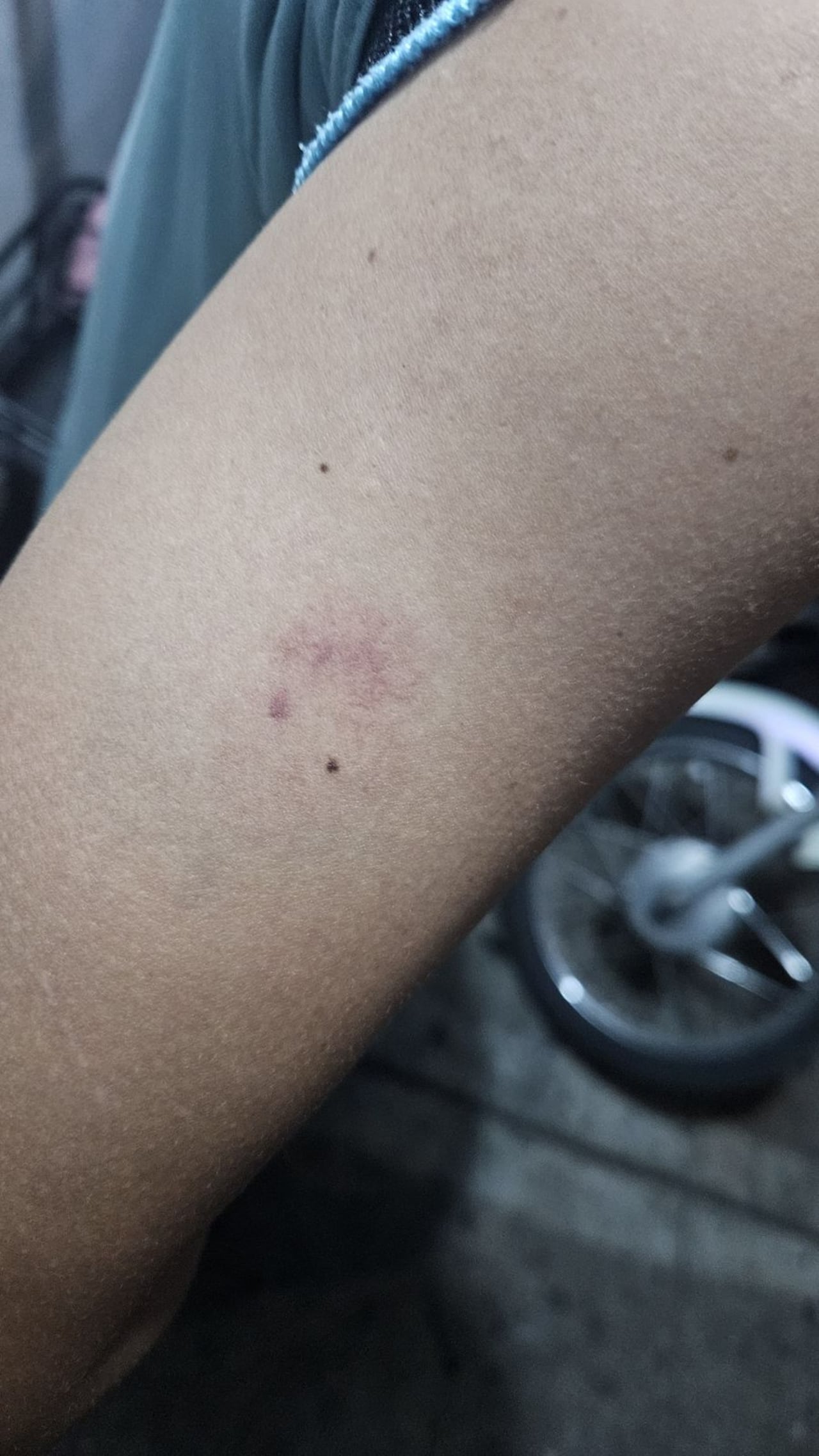 Una mujer le arrebató los documentos a un agente y lo mordió en uno de sus brazos, denunció la Secretaría de Movilidad de Cali.