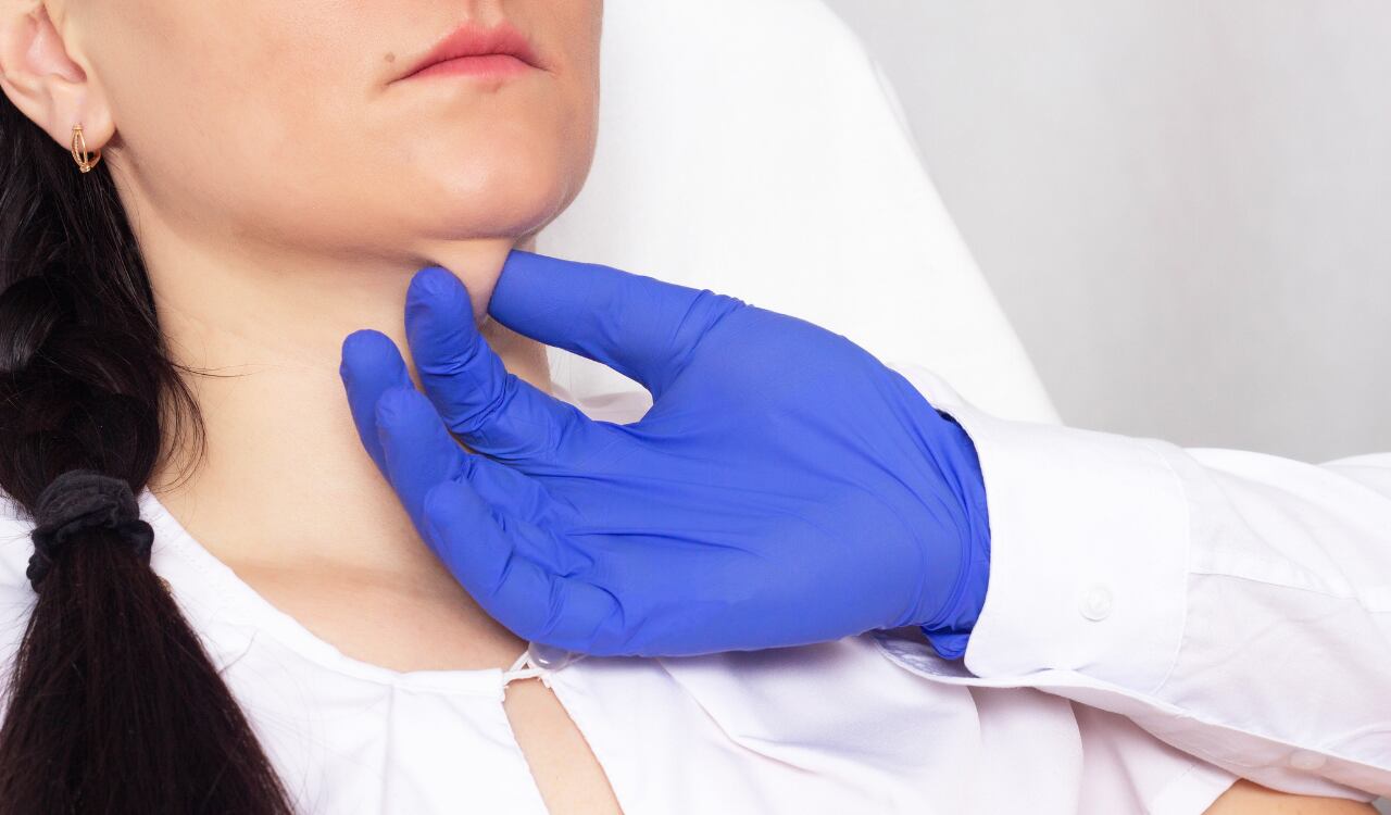 Aceites y algunos ejercicios pueden mejorar la apariencia de la papada.