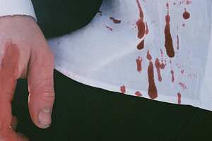 Las manchas de sangre pueden eliminarse con bicarbonato de sodio.