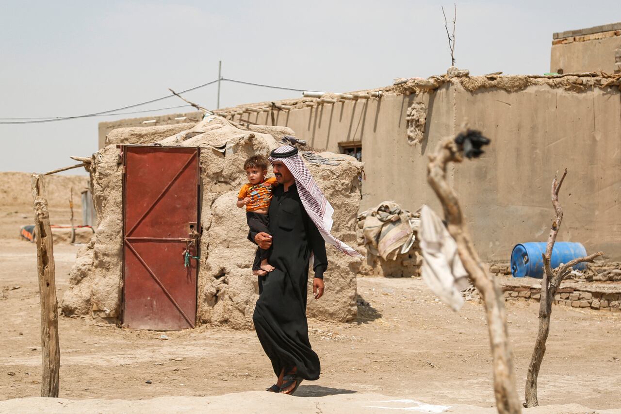 Un preocupado padre iraquí de siete hijos señala una ampolla en la cara de su hija de un año, resultado de una infección parasitaria transmitida por flebótomos en su remota aldea.