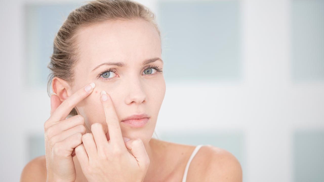 Técnicas recomendadas para la extracción de barros son presentadas por dermatólogos.