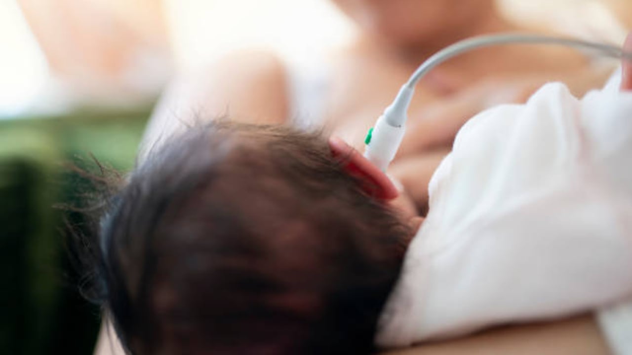 Según la OMS, el tamizaje auditivo neonatal es una actividad costo-efectiva, con un rendimiento del 67 % (1.67 dólares internacionales recuperados por cada dólar invertido).