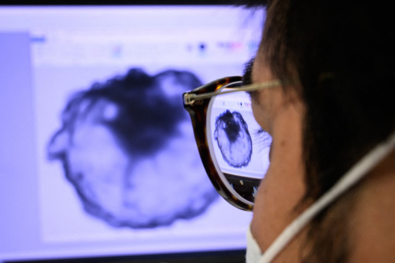 Un investigador revisa un monitor que muestra un tumor en un laboratorio de experimentación animal de la Universidad de Ginebra.
