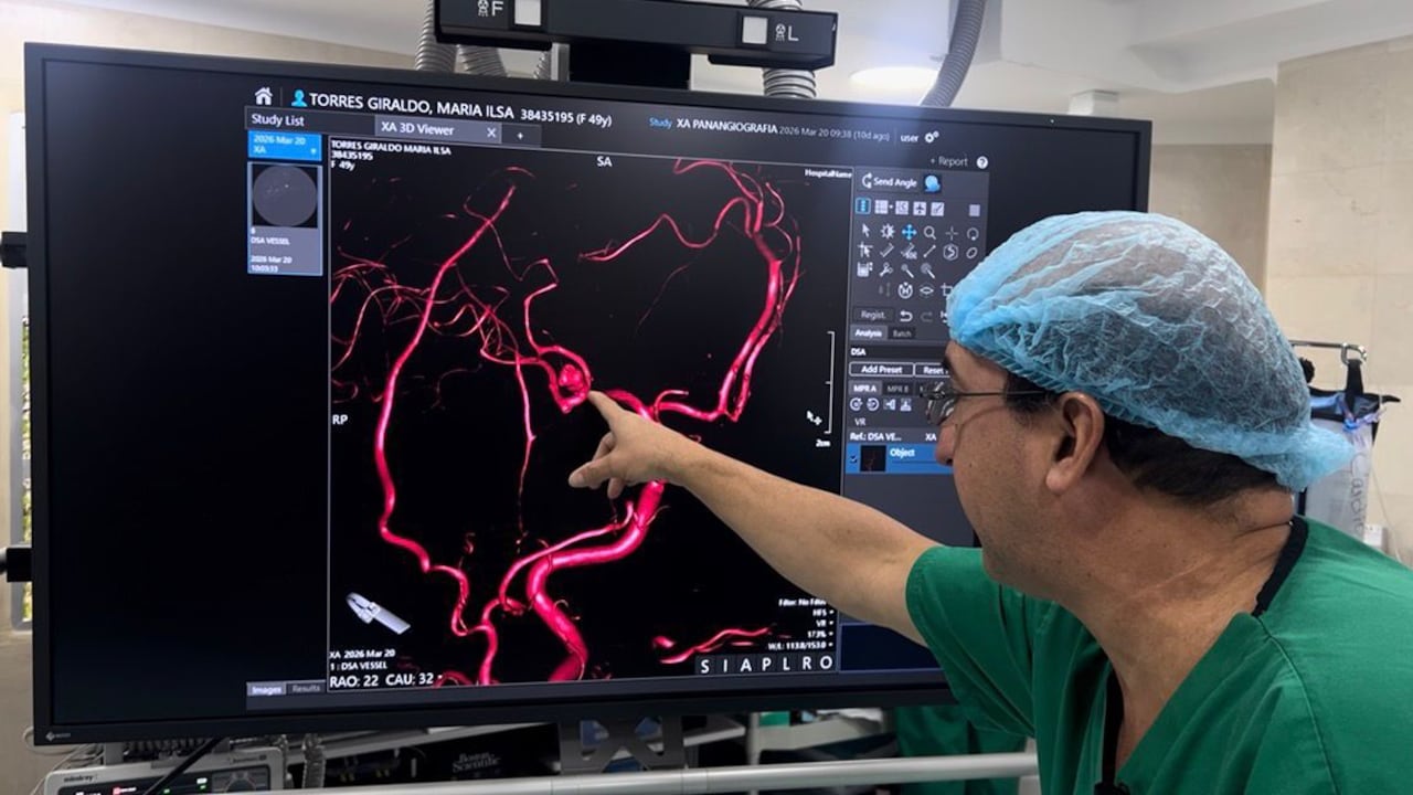 Nuevo angiógrafo permite diagnósticos vasculares en tiempo real en Cali.