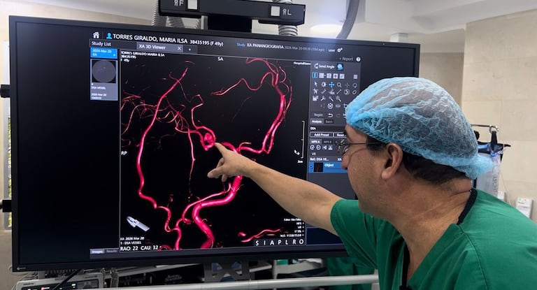 Nuevo angiógrafo permite diagnósticos vasculares en tiempo real en Cali.