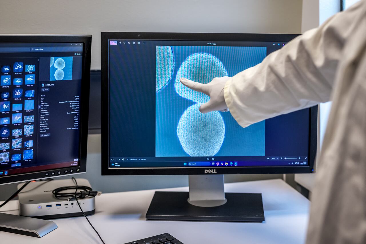 Una pantalla que muestra neuronas humanas es fotografiada en la startup suiza FinalSpark en Vevey.