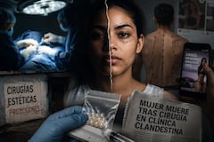 Incrustarse esferas en el pene, del tamaño de un dado, es una práctica que comenzó en las cárceles de Estados Unidos.
