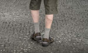 Las venas varices se pueden presentar por diferentes motivos como permanecer mucho tiempo de pie o sentado.