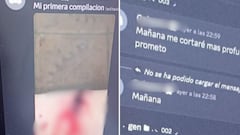 Autoridades en Cali activaron una ruta de atención para el menor de 13 años tras detectarse conductas de autolesión difundidas en espacios virtuales y la manifestación de ideas suicidas.