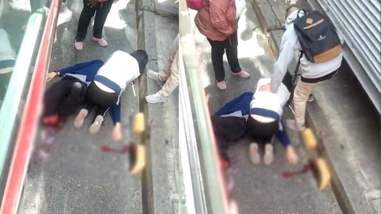 La persona que estuvo a punto de colarse en la estación de Fucha, perdió parte de su pierna izquierda.