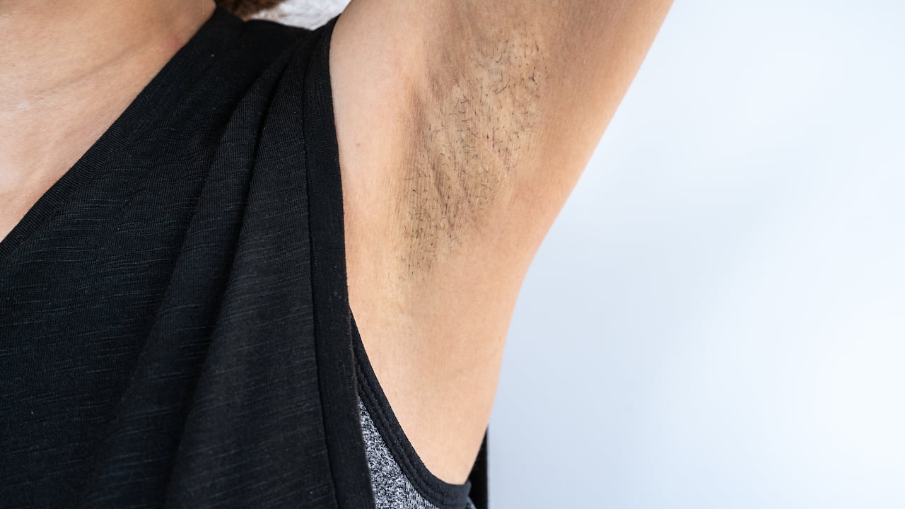 Este tipo de problema suele afectar en mayor medida a las mujeres.