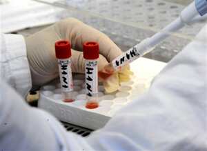 Las mujeres embarazadas, los diabéticos y aquellas personas que tienen un sistema inmunológico debilitado han sido más vulnerables a las infecciones graves con H1N1.