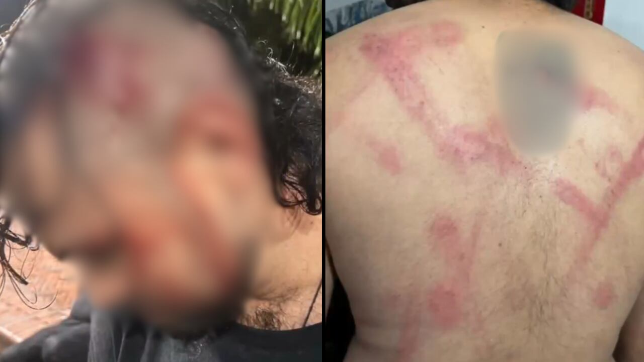 Uno de los ciudadanos resultó lesionado en medio de la situación.