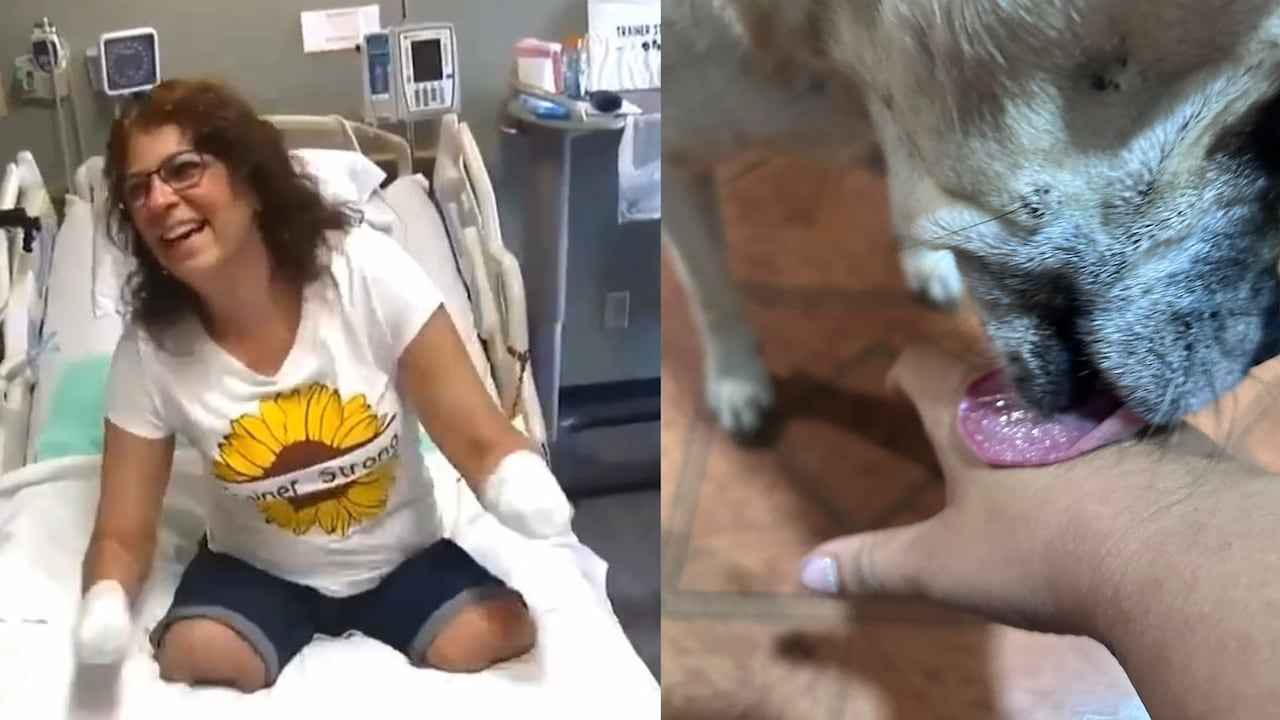 Un lamido que cambió su vida: mujer perdió brazos y piernas tras infección transmitida por su perro