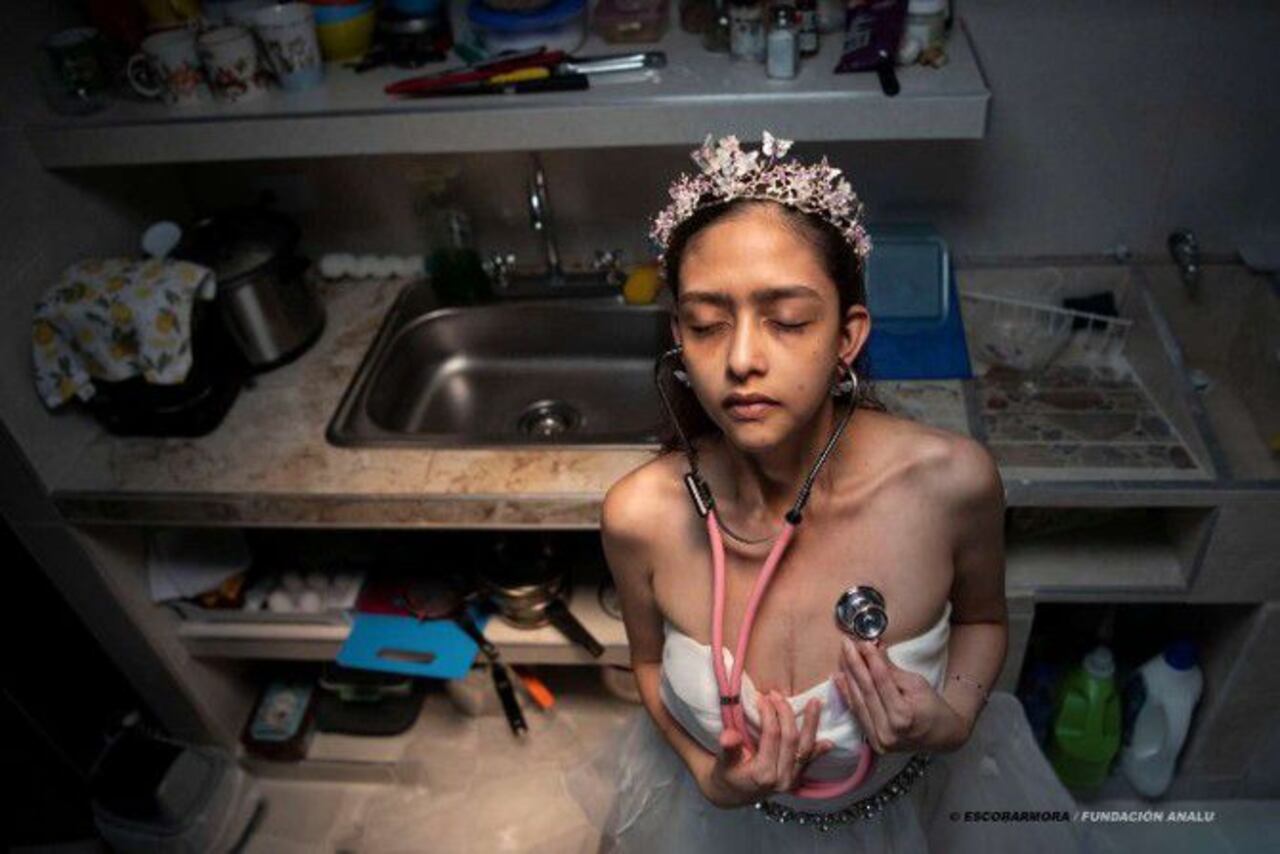 A través del lente de Christian Escobar Mora, fotoperiodista internacional y cuidador de una paciente con lupus, esta exposición revela lo que no grita, pero insiste en vivir: cuerpos que resisten, rutinas que se vuelven promesas y emociones que no aparecen en ningún laboratorio.