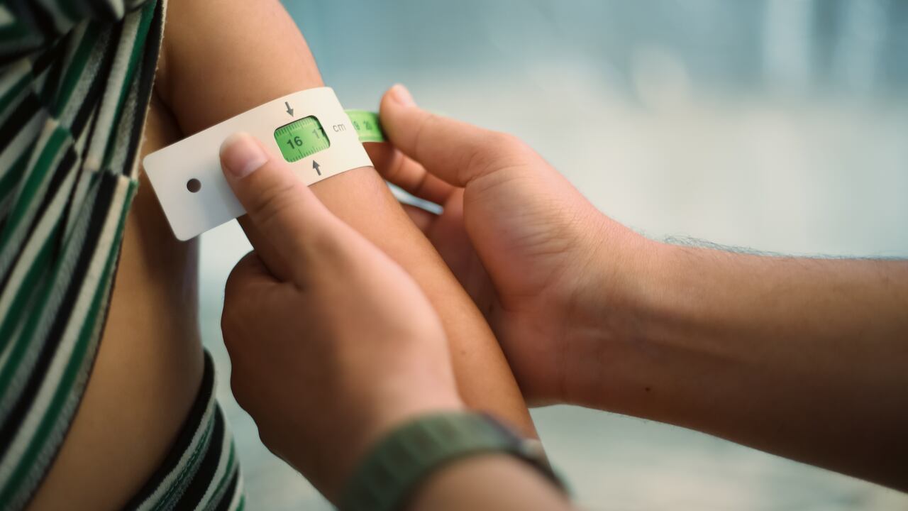 Desnutrición en niños