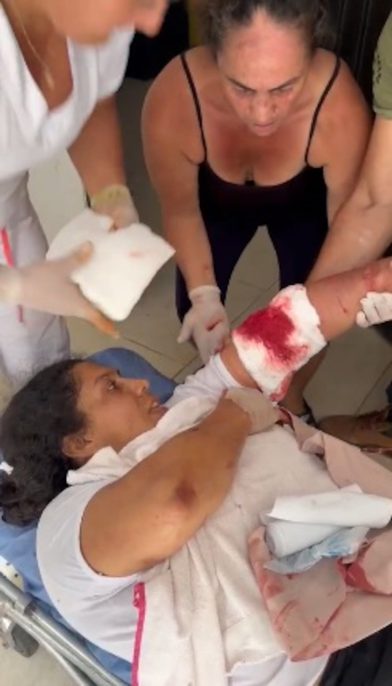 Este es una de las dos mujeres, amas de casa, que resultaron lesionados al quedar en medio de los enfrentamientos.