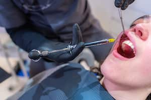 Todo se originó por una cordal que tenía infectada.