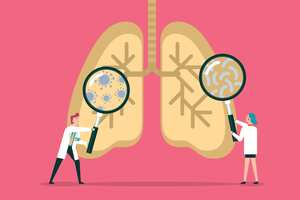 Equipo de médicos diagnostican pulmones humanos