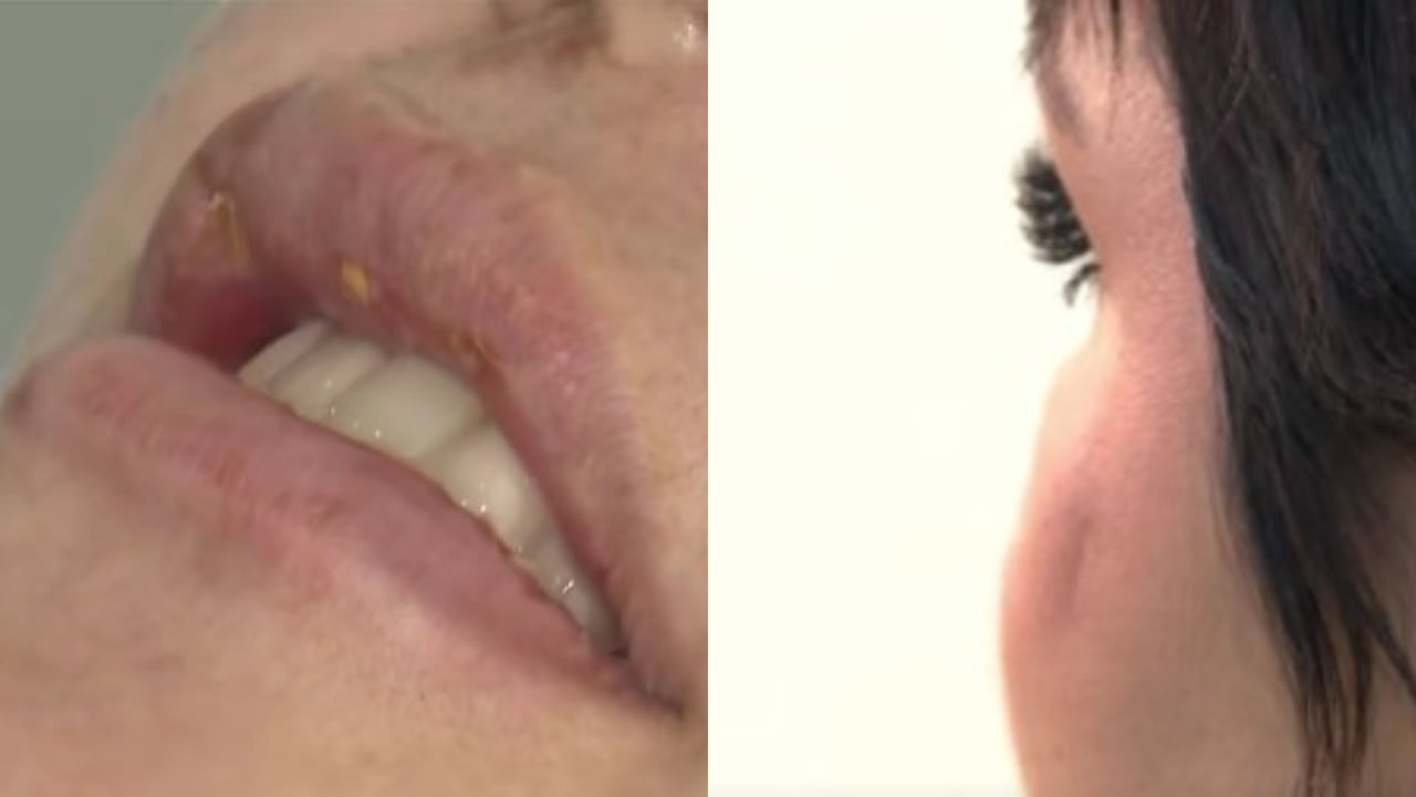 Karina Rincón, víctima de intento de feminicidio