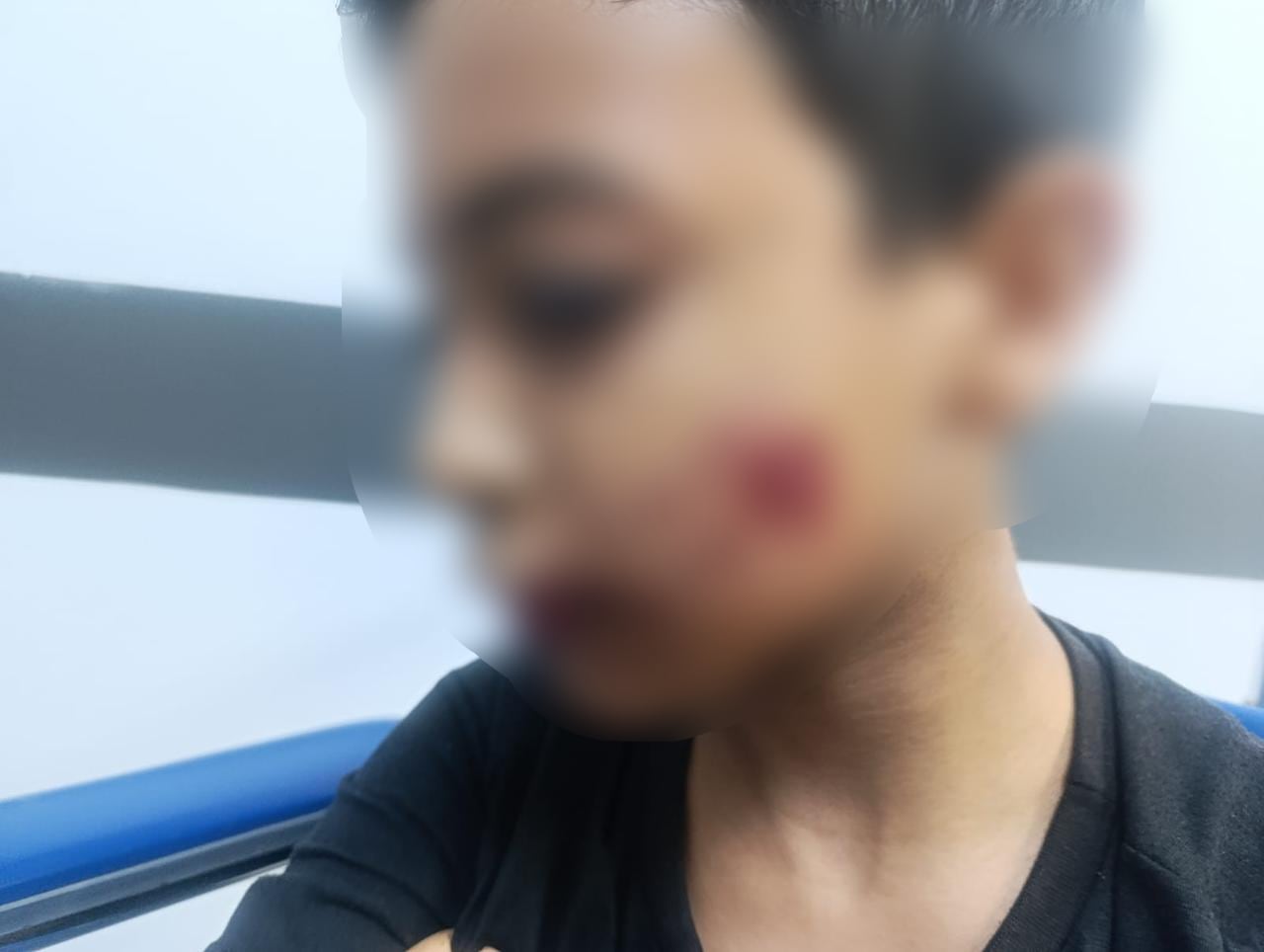 El pequeño requirió cirugía maxilofacial debido a la gravedad de las heridas que recibió en el rostro.