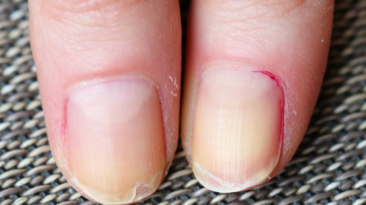 Las uñas de las manos y de los pies se ven afectadas por varias afecciones.