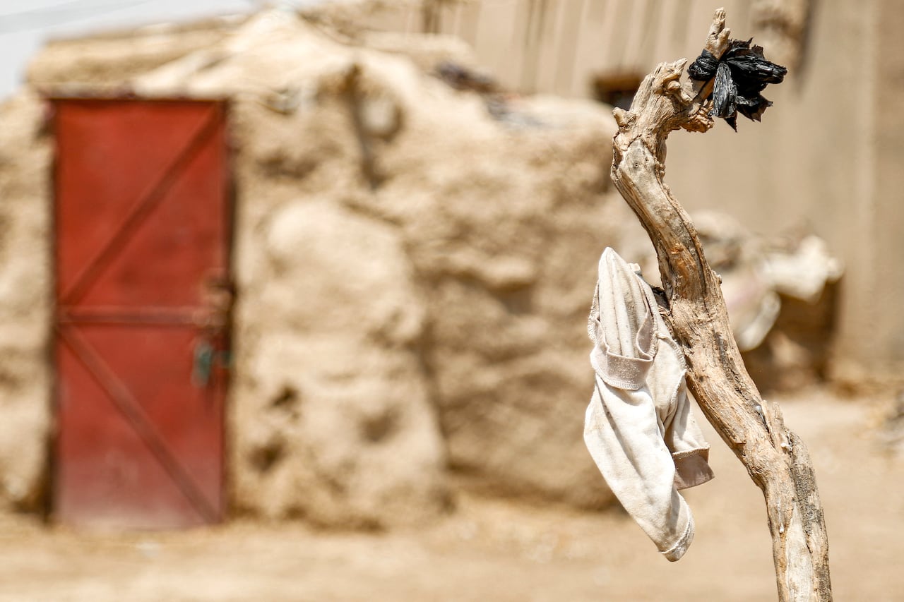 Un preocupado padre iraquí de siete hijos señala una ampolla en la cara de su hija de un año, resultado de una infección parasitaria transmitida por flebótomos en su remota aldea.