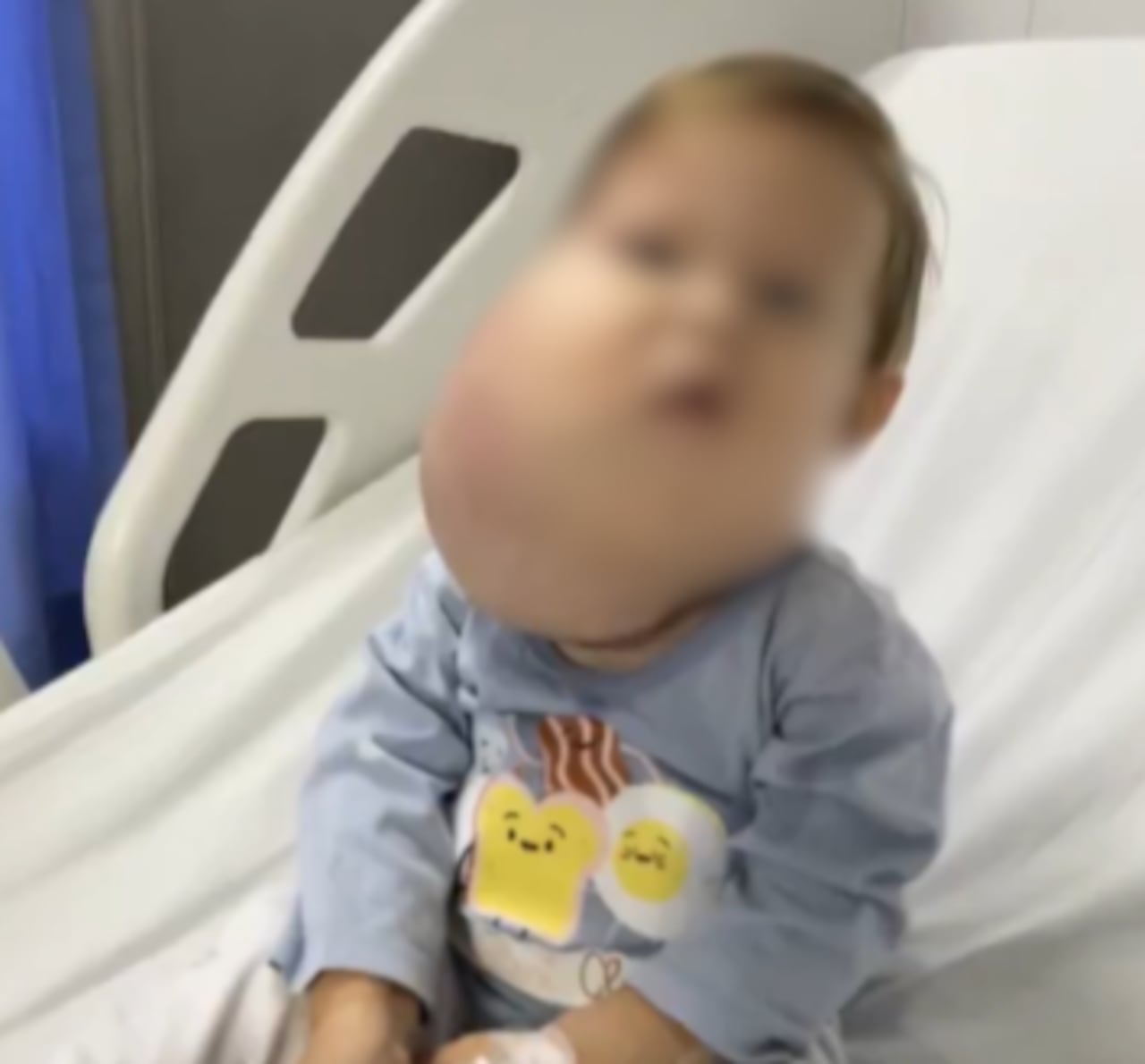 El niño tenía una malformación en su rostro y un problema pulmonar que causó su deceso.
