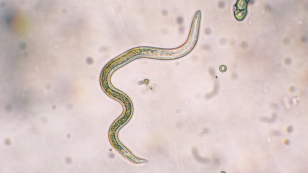 Parásitos intestinales