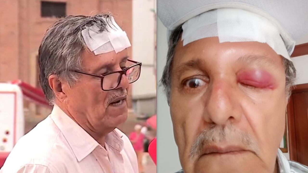 Hugo Romero fue agredido por un motociclista al norte de Cali.