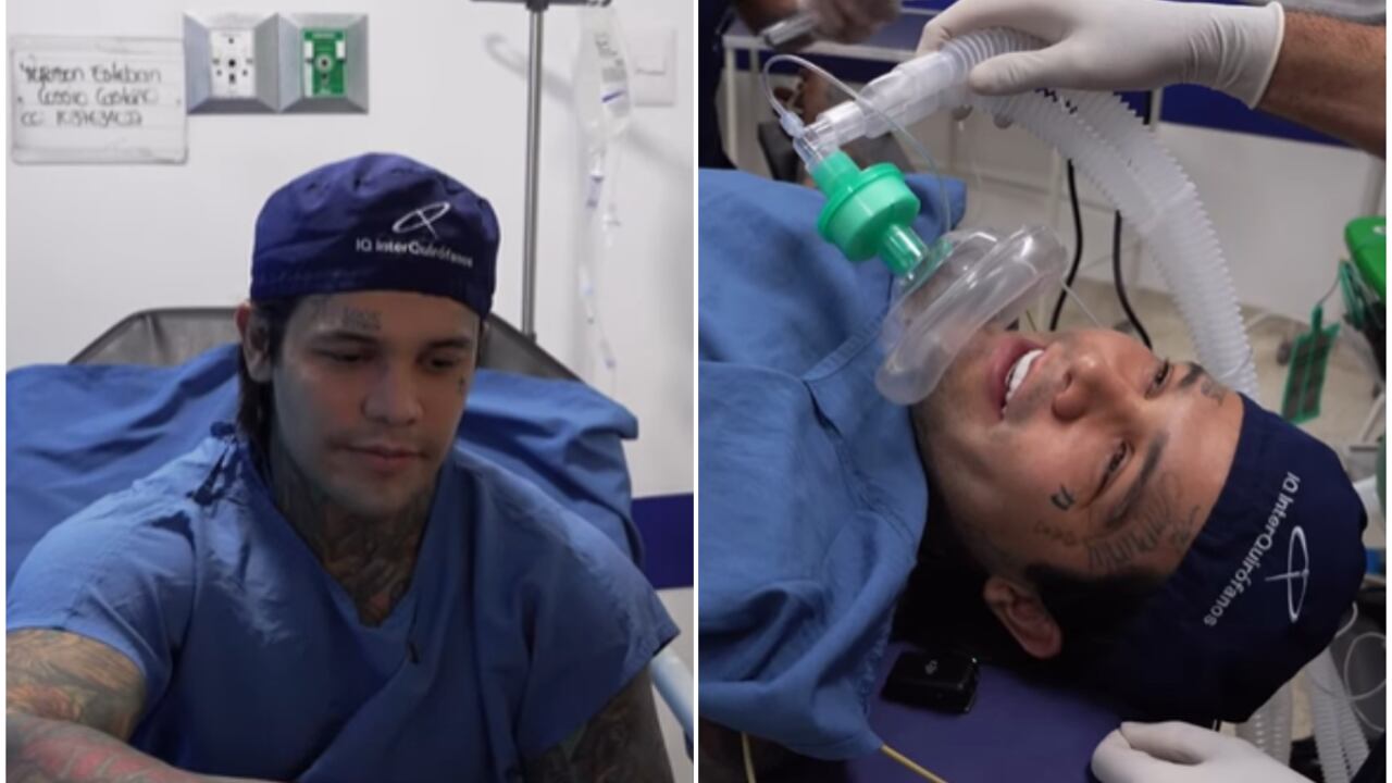 Esta fue la nueva cirugía que se practicó Yeferson Cossio: “la más dolorosa del mundo” - El País