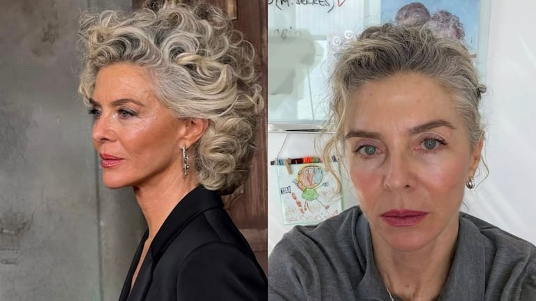 Margarita Rosa de Francisco compartió nuevas imágenes en las que mostró el antes y el después de su procedimiento estético y permitió apreciar el cambio en su rostro.