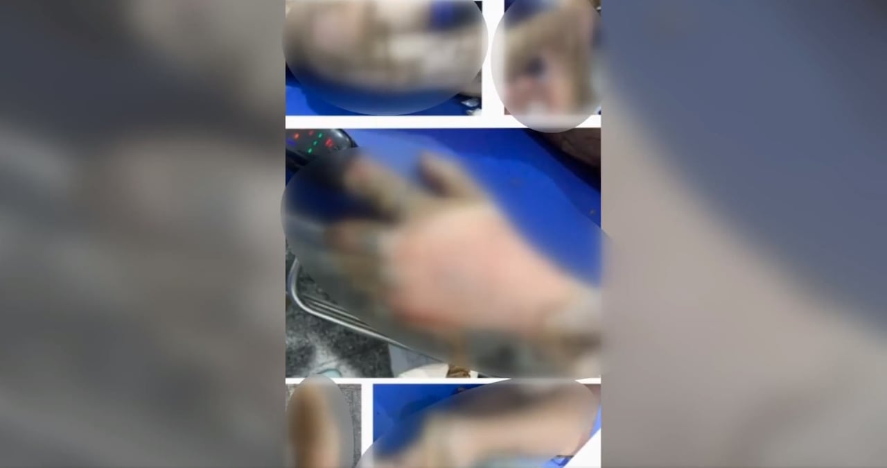 Hombre 'revivió' después de ser declarado