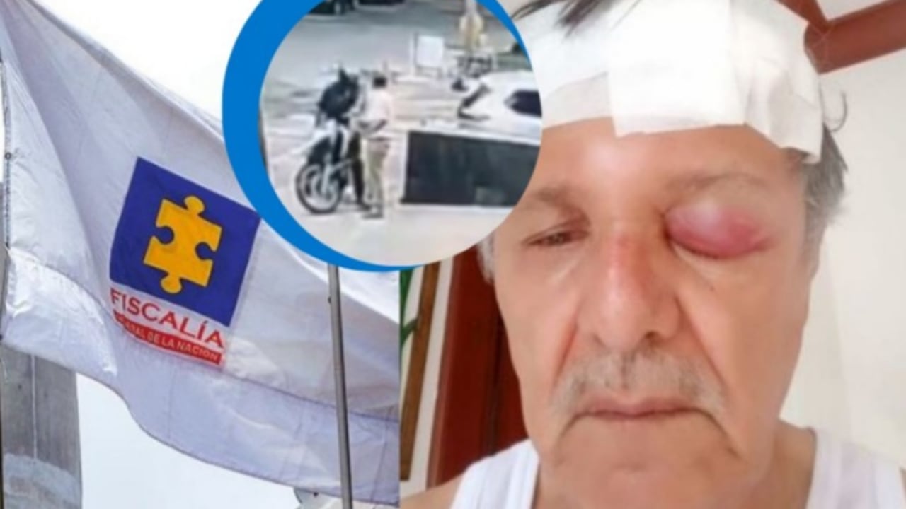 Agresión a Hugo Romero: Fiscalía avanza en identificación del atacante.