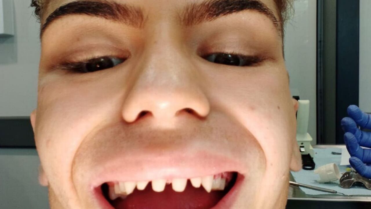 Jack dijo que sus dientes quedaron como los de un tiburón.