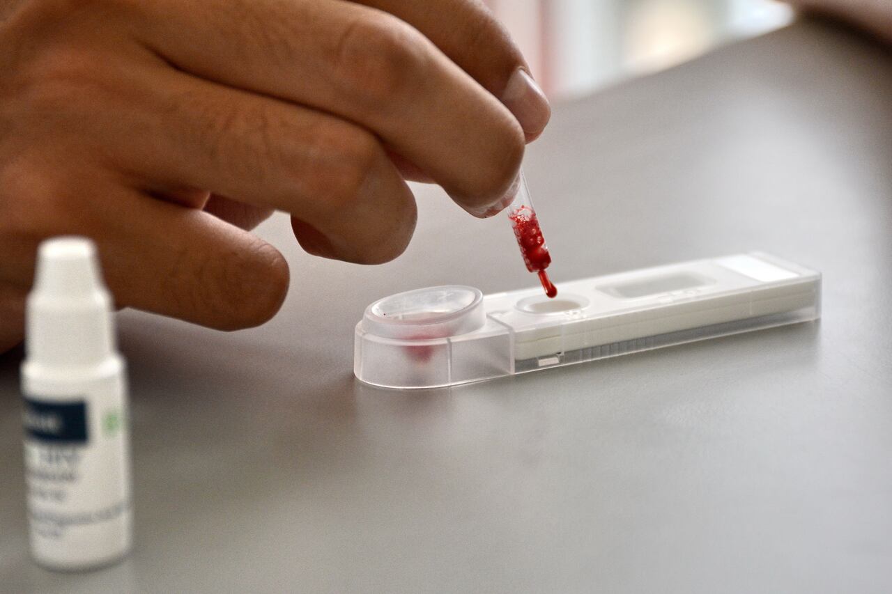 En el Hospital de Siloé, se puede acceder a pruebas gratuitas de VIH. La Secretaría de Salud de Cali ha instalado una máquina dispensadora de autotest de VIH en este centro de salud, la cual permite realizar pruebas rápidas, privadas y en solo 15 minutos. Foto Jorge Orozco /El País