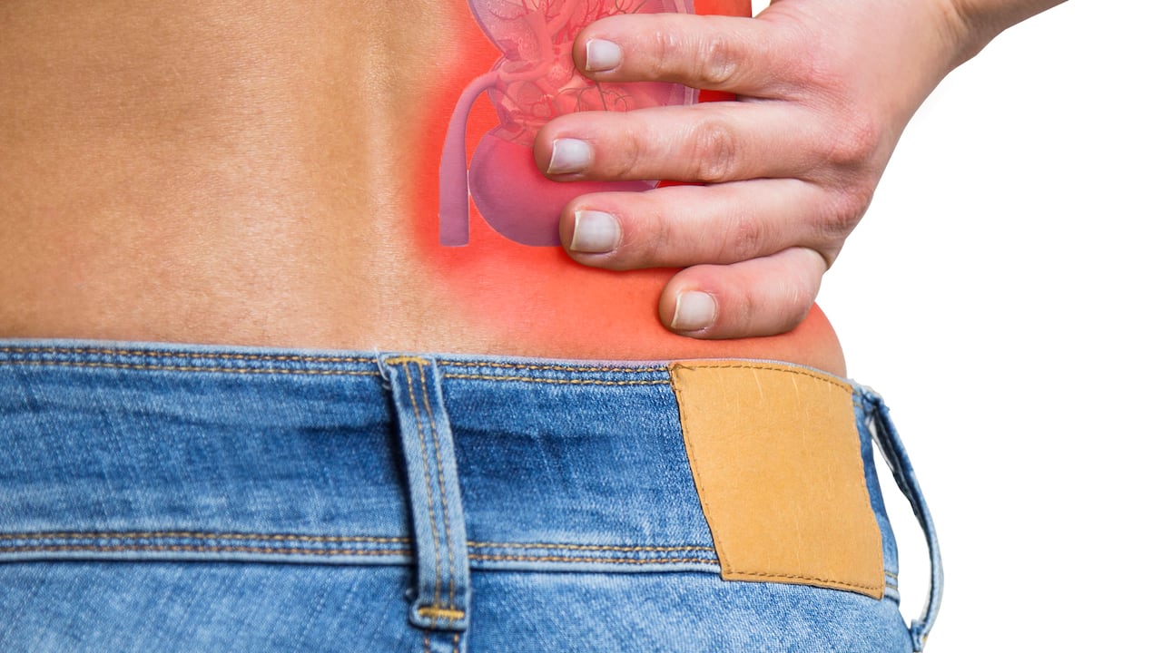 Cálculos en los riñones