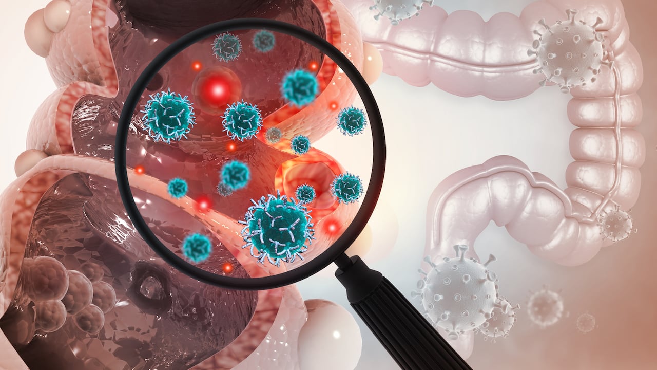 Este es uno de los cánceres más comunes en todo el mundo.