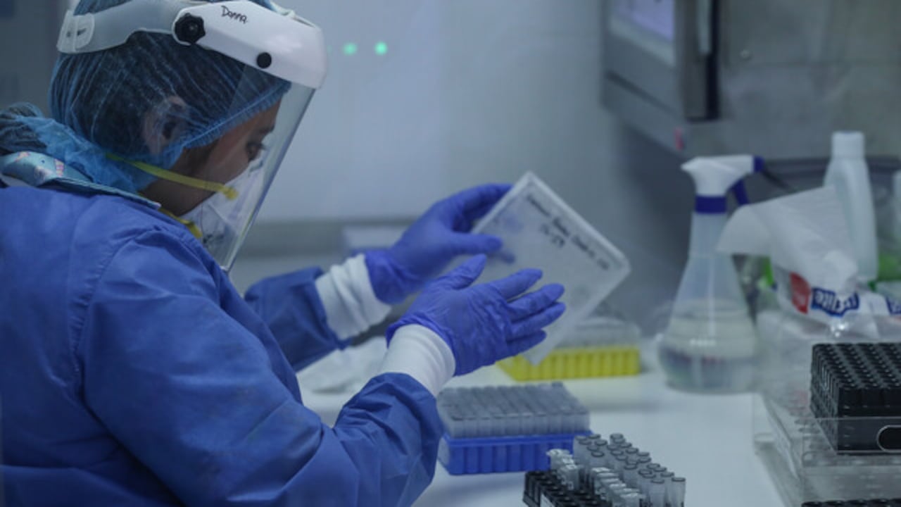 Agosto 12 de 2020. En el Instituto Distrital de Ciencia, Biotecnología e Innovación en Salud (IDCBIS) se llevan a cabo los estudios del uso de plasma de convalecientes para el tratamiento de pacientes con covid-19. El análisis mostró eficacia en el 80% de los casos tratados con este plasma, (Colprensa - Camila Díaz)