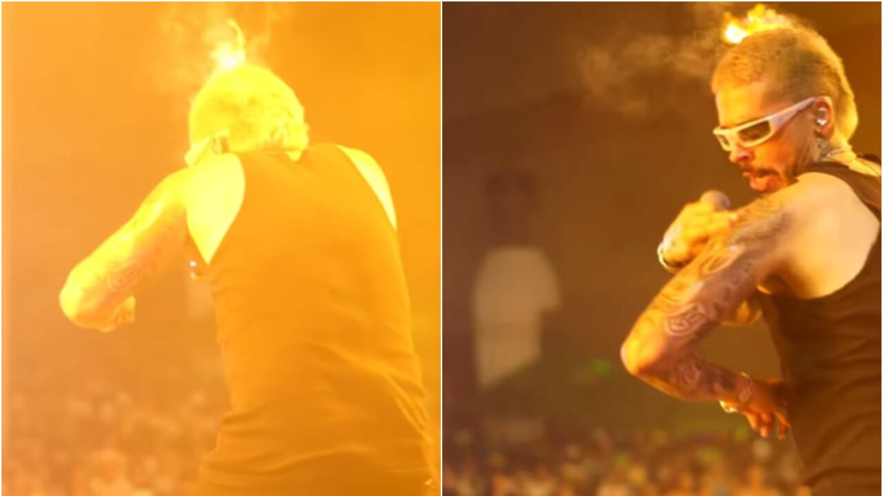 El reguetonero Reykon sufrió un accidente cuando se encontraba en concierto en Neiva, en medio de las fiestas de San Pedro.