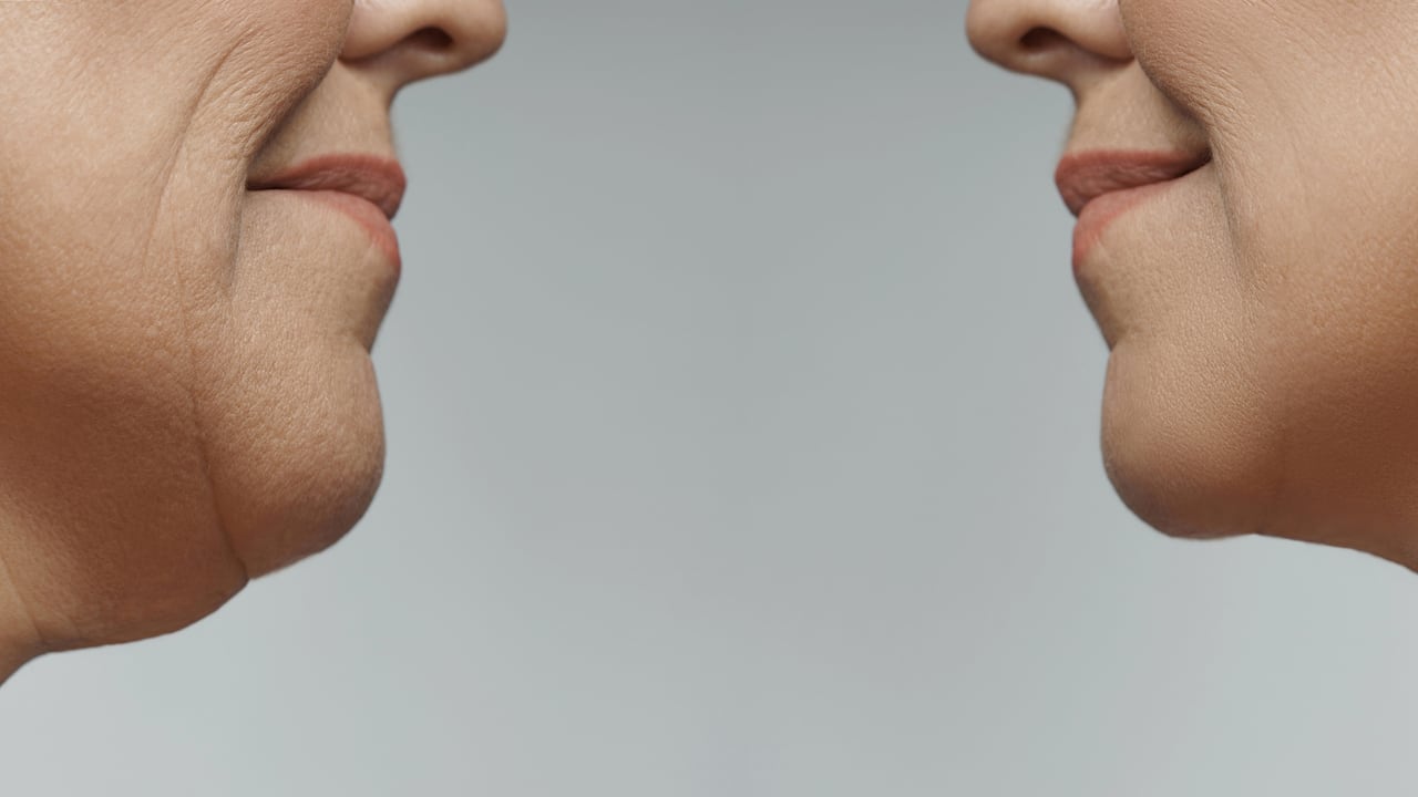 Los videos relacionados con el 'Mewing' han inundado las feeds de TikTok, alimentando la curiosidad y el escepticismo en igual medida sobre esta práctica.