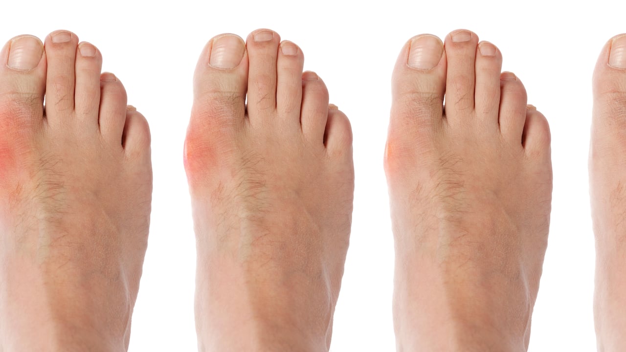 La falta de movimiento puede hacer hinchar los pies.